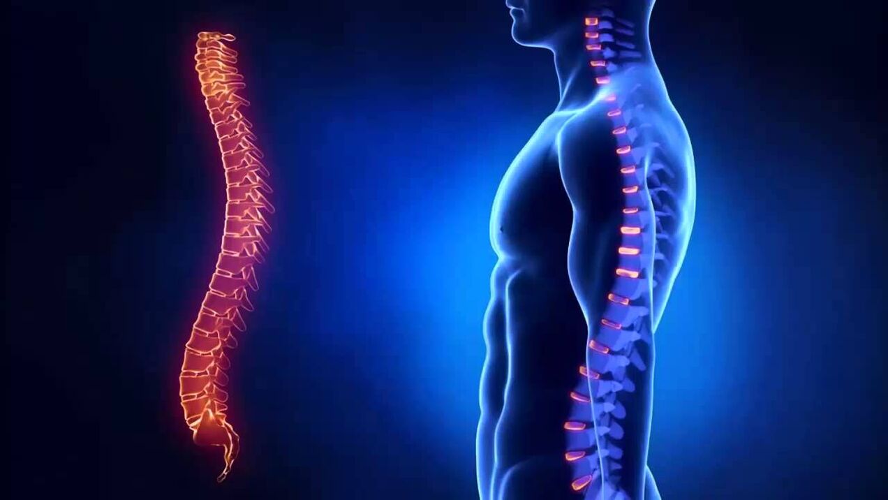 Osteochondrose wird nach den Teilen der Wirbelsäule klassifiziert, in denen sich die Krankheit entwickelt.